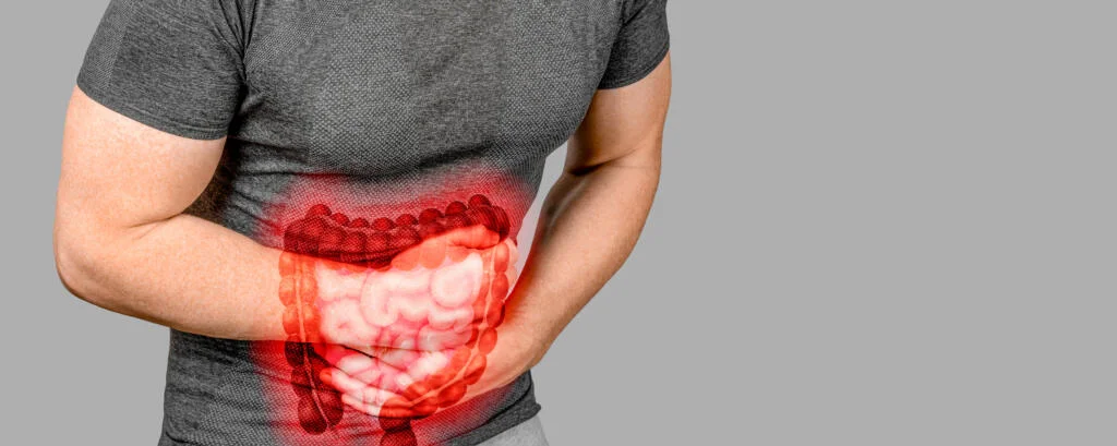 Bowel Syndrome