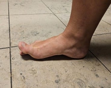 Grosszeh heben, aber die Zehen bleiben unten.